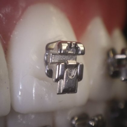 BRACKETS AUTOLIGADOS H4